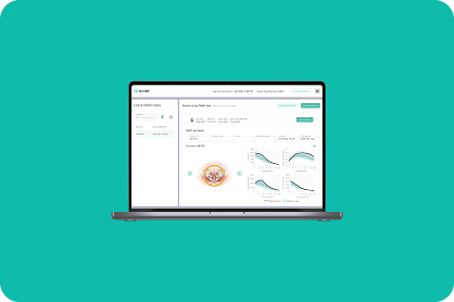 Ekran laptopa prezentujący medyczny dashboard platformy ONIRY zaprojektowany przez itCraft, wyświetlający wyniki testów diagnostycznych pacjenta, wykresy częstotliwości oraz dane medyczne.